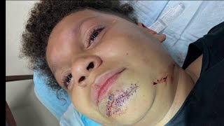 Mom fights to protect son after brutal attack at Campbell Middle School