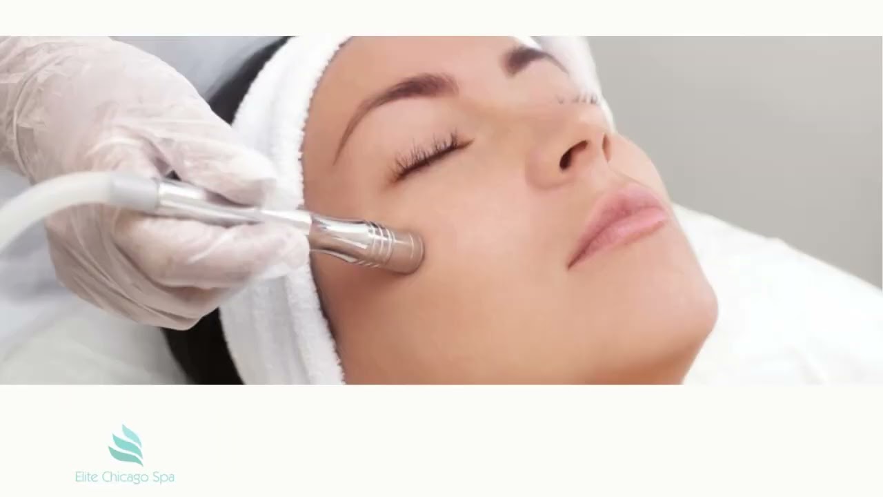 Microderm In Chicago YouTube