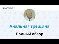 Анальная трещина: почему нельзя игнорировать? Обзор, симптомы, диагностика, лечение, профилактика.