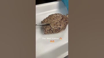 Sheep 🧠 dissection 🔥🔥 #viralvideo #foryou