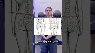 Дисфункция таза, как устранить? #реабилитация #массаж #перекостаза