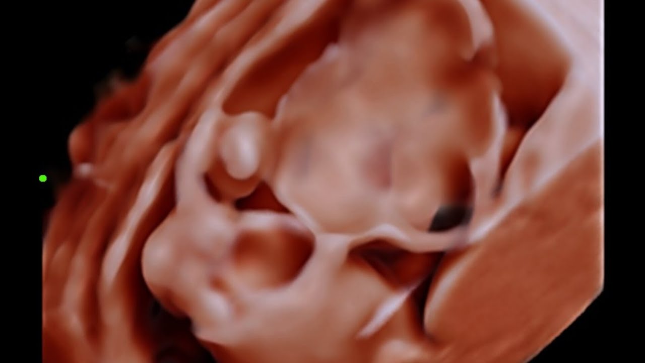 Wt u think 🤔? Follow the hashtag #ultrascan_fetal_ultrasound_school 