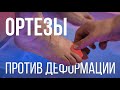 Ортезы – ЧТО ЛЕЧАТ?