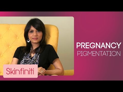 Video: Pigmentation After Pregnancy - How To Get Rid Of?