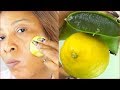 2 INGREDIENTS, LEMON AND ALOE VERA, CAN MAKE YOUR SKIN FRESHER, YOUNGER +GLOWING IN JUST 3 MINUTES