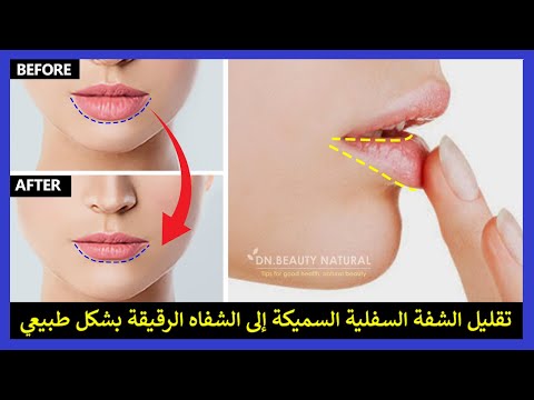 4 خطوات سهلة لتقليل الشفتين السفلية السميكة إلى شفاه أرق بشكل طبيعي بدون جراحة
