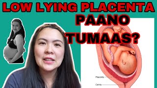 LOW LYING PLACENTA / PLACENTA PREVIA / PAANO TUMAAS ANG PLACENTA KO? screenshot 4