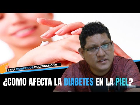 ESTOS SON LOS 8 EFECTOS DE LA DIABETES EN LA PIEL