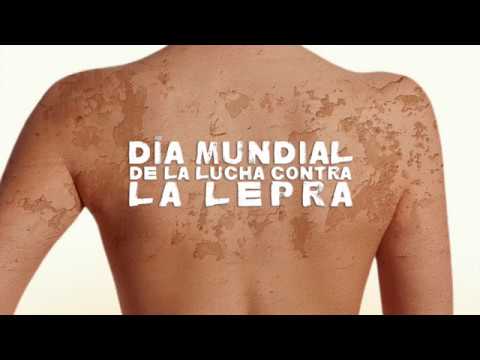 Vídeo: Lucha Contra La Lepra. Lucha Contra El Estigma. - Red Matador