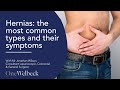 What are the commonest types of hernias and what are the symptoms?