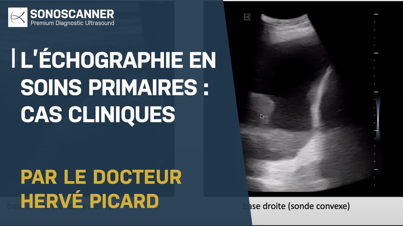 Webinar Médecine Générale - L'échographie en soins primaires : Cas