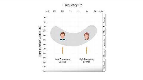 Understanding an Audiogram