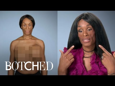 Koffa Wants "Botched" Doctors To Solve Her Medical Mystery | Botched | E!
