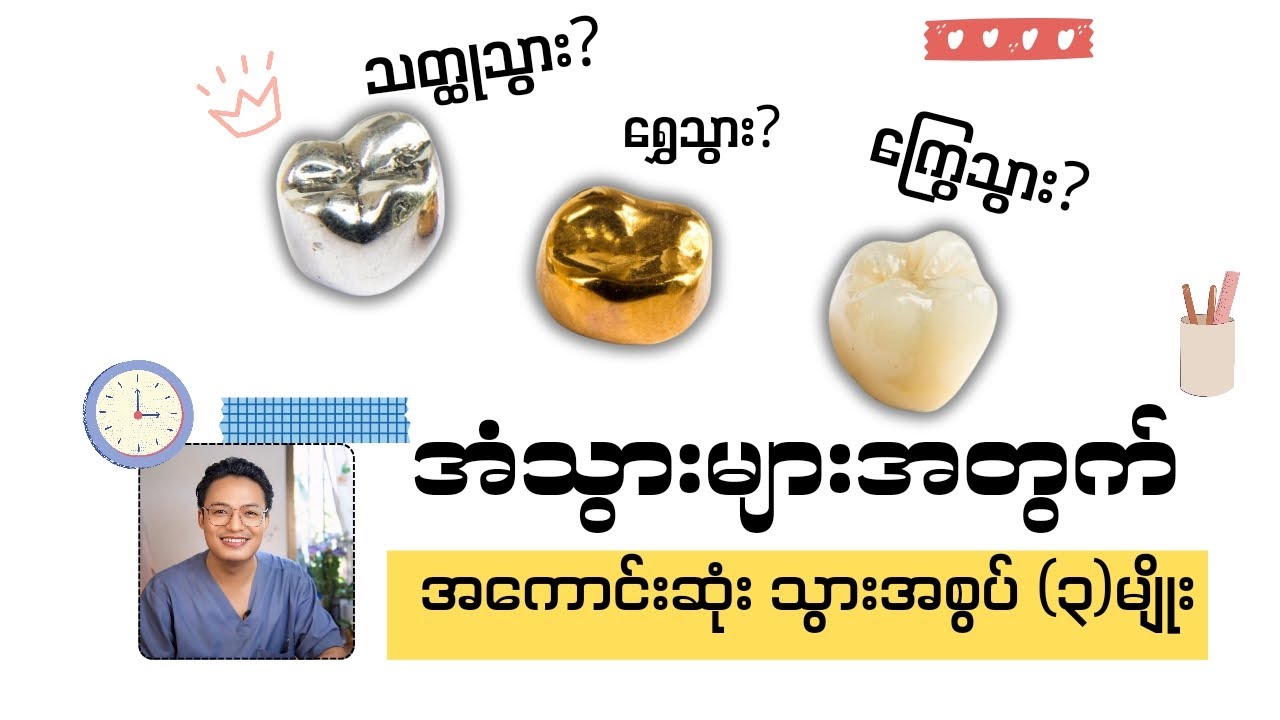 အံသွားများအတွက် အကောင်းဆုံး သွားအစွပ် (၃)မျိုး