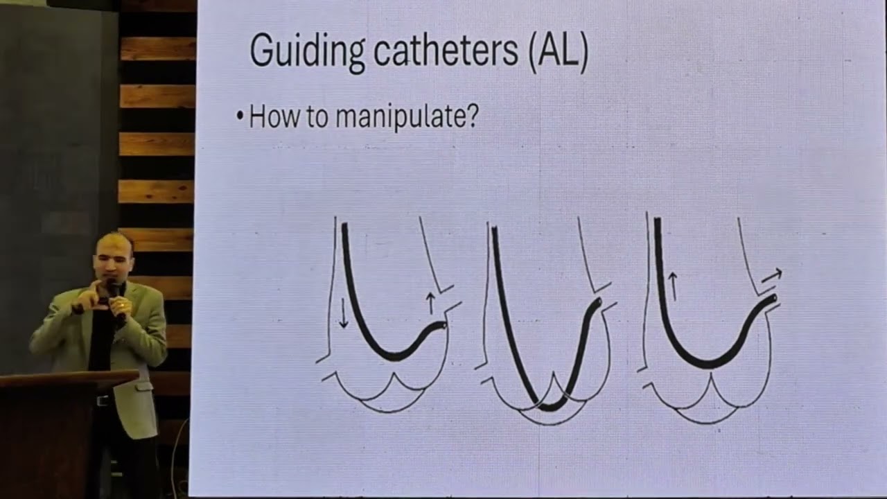 Coronary intervention pitfalls start from basics part 3 art of catheter selection and engagement 