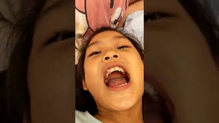 第一次爸牙!201706212224
