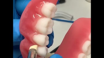 How to make esthetic print dentures!