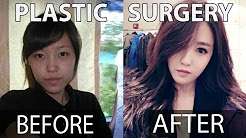 10 KPOP STARS BEFORE AND AFTER PLASTIC SURGERY | MisuP