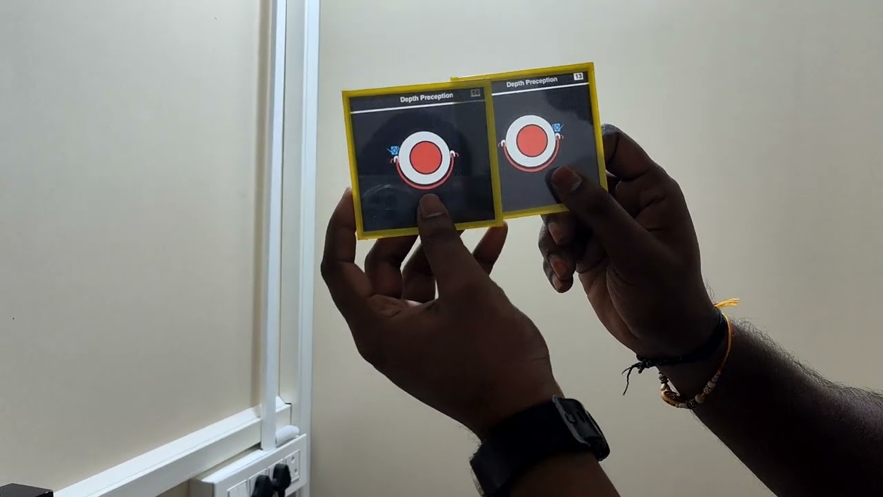 Ravikanth M. Clinical Practical, Fellowship in Pediatric Optometry, NCVRT, Batch 12 January 2025