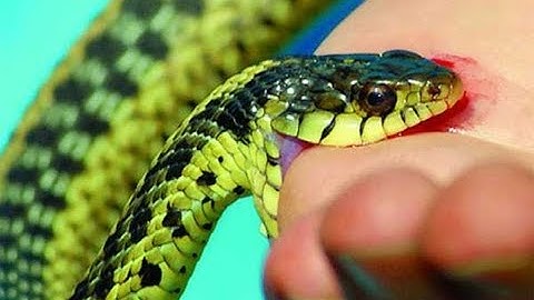 Nhiều người nhập viện vì rắn độc cắn