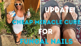 UPDATE! CHEAP MIRACLE CURE FOR FUNGAL NAILS - HOW TO TREAT UGLY TOENAIL FUNGUS