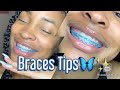 TIPS FOR BRACES✨ | Do’s & Don’t !