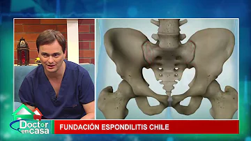 ¿Cómo se siente la espondilitis?