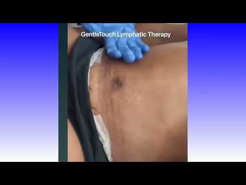 GentleTouch Lymphatic Therapy