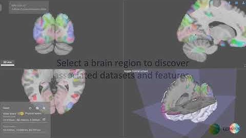 EBRAINS - Exploring the multilevel Human Brain Atlas