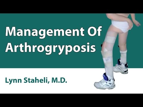 Management Of Arthrogryposis