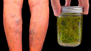 Unbelievable! Varicose veins disappear with rosemary! Treasure that everyone should have in the