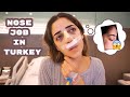 RHINOPLASTY (NOSE JOB) IN TURKEY !! FULL EXPERIENCE + CAST REMOVAL