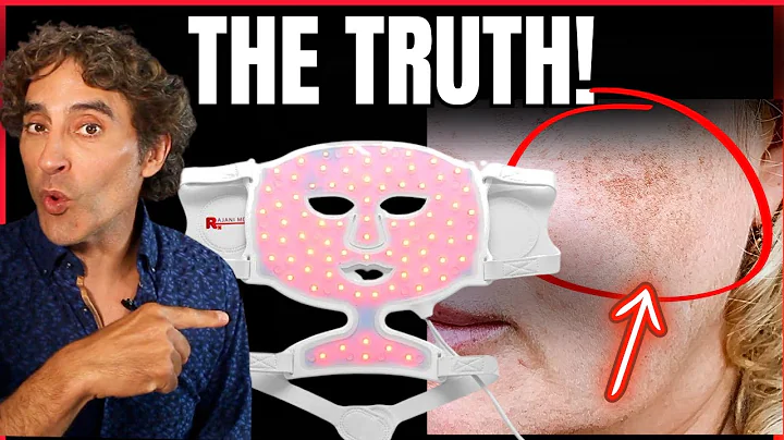 LED MASK RISKS // Will Your Led Mask Cause Melasma and Pigment?