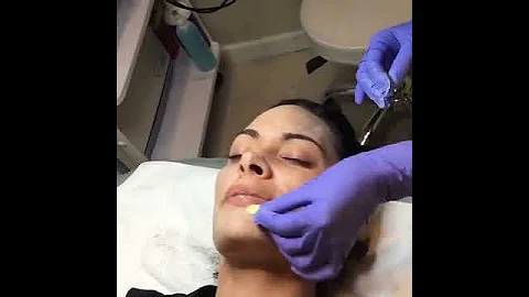 Getting Glowing with the ZO 3-Step Peel ✨