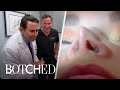 &quot;Botched&quot; Docs Worried About Patient&#39;s Thin Nose | E!