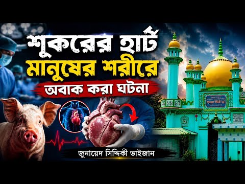 শূকরের হার্ট মানুষের শরীরে অবাক হবেন┇জুনায়েদ সিদ্দিকী জলসা┇junaid siddiqui jalsa┇junaid siddiqui waz