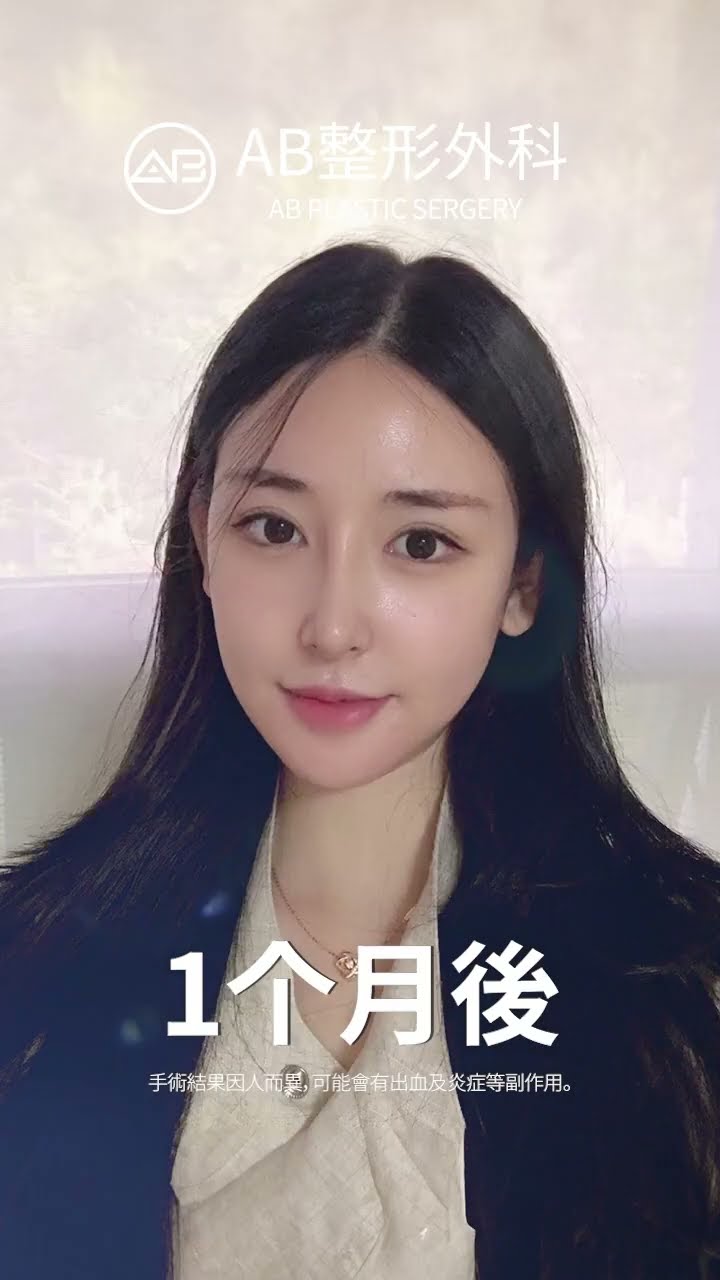 「眼鼻下颌手术大变身！从可爱到惊艳😍✨」#热门 #推荐