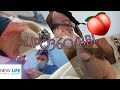 SURGERY VLOG💉 | BBL | Sparkle Lei'✨