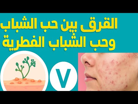 الحبوب الفطرية الفرق بينها وبين الحبوب العادية وطرق الوقايه والعلاج