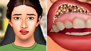 Asmr Remove Botfly Maggots Found Inside Mountaineers Mouth Dental Care Animation Beauty Asmr