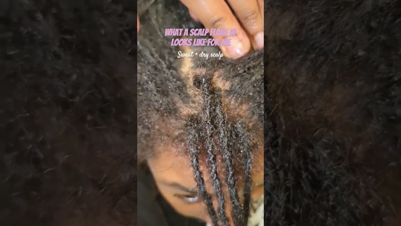 These flare ups happen every season change... 