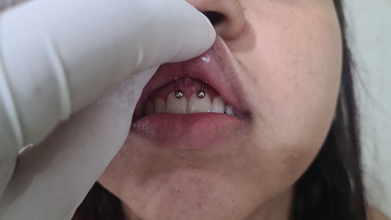 Smile piercing