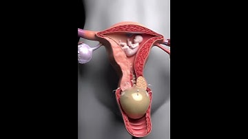 Why Sperm Can’t Enter: Cervical Mucus Plug Explained in 3D