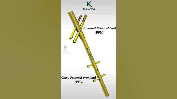 Proximal Femoral Nail (PFN)Clavo Femoral Proximal (PFN)#orthopedic #orthopedicsurgery #orthopedics