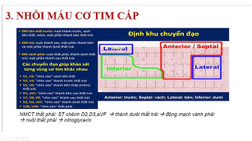 Nhồi máu cơ tim   Điện tâm đồ chẩn đoán định khu   Ôn Thi Bác Sĩ Nội Trú