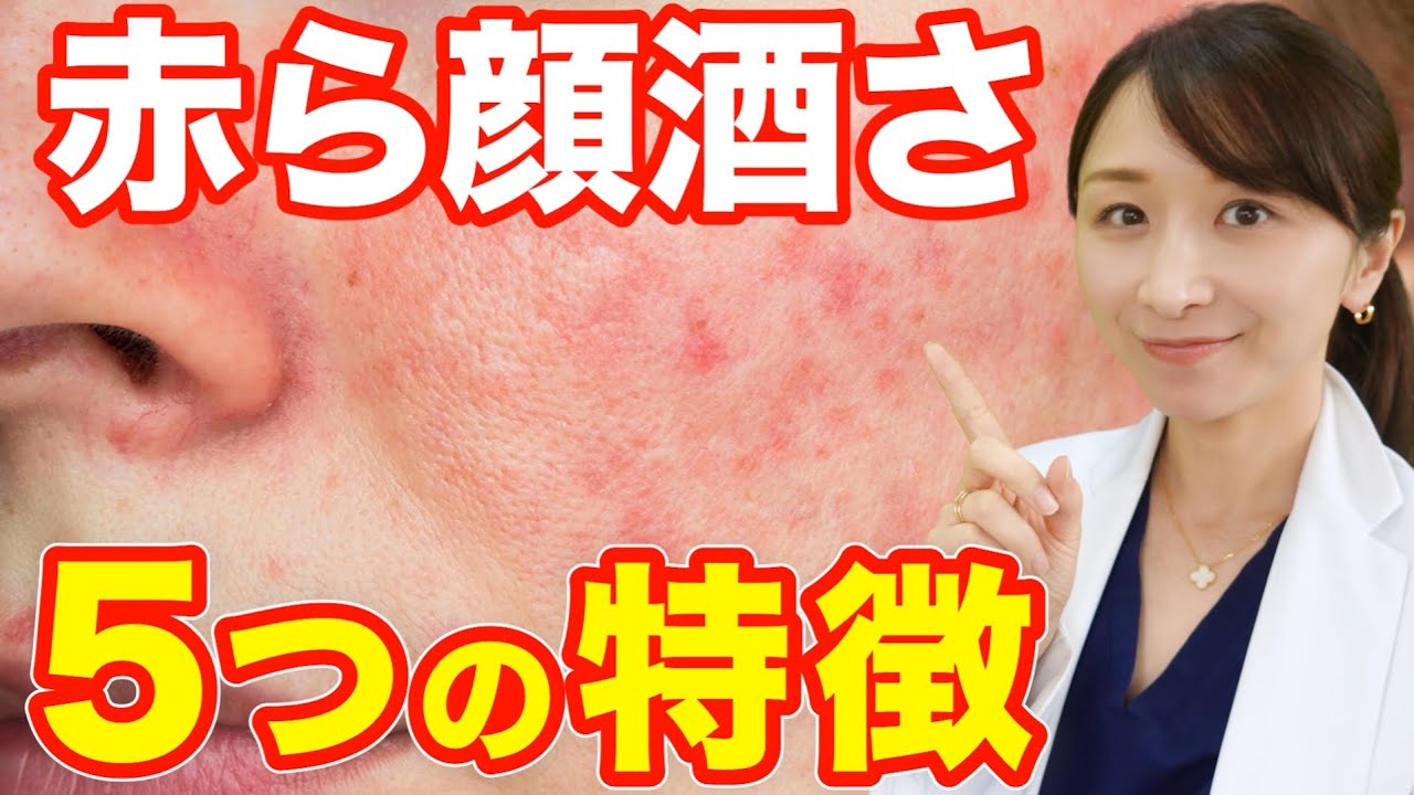 【セルフチェック】外来でよく聞く酒さの症状トップ５を皮膚科専門医が解説