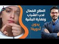 ١٥٢-حب الشباب ونضارة البشره/ خطوات بسيطه وسهله لتحصل علي بشره ناعمة بدون دواء