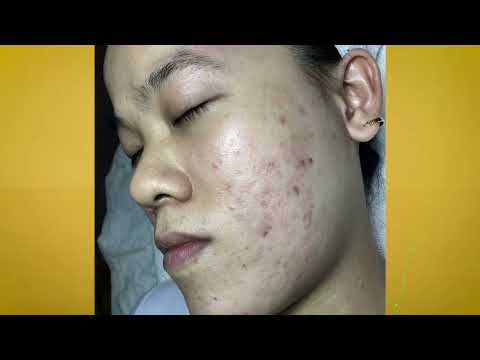 Video Đi một vòng mới nhận ra HHV Clinic là chân ái | HHV... - youtube