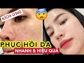 CÁCH PHỤC HỒI DA KÍCH ỨNG GIÁ RẺ | NHANH VÀ HIỆU QUẢ CHỈ TRONG 3 NGÀY!!!