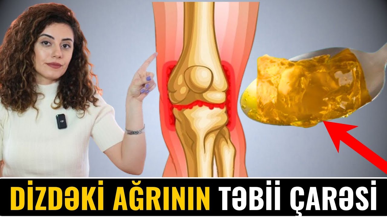 Çinlilər DİZ AĞRISININ Çarəsini Tapıb - Oynaqlarda Maye Azalıbsa, Bunu Edin!